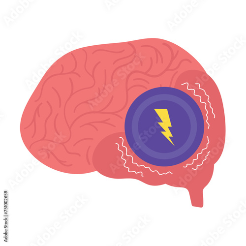 parkinson brain disease