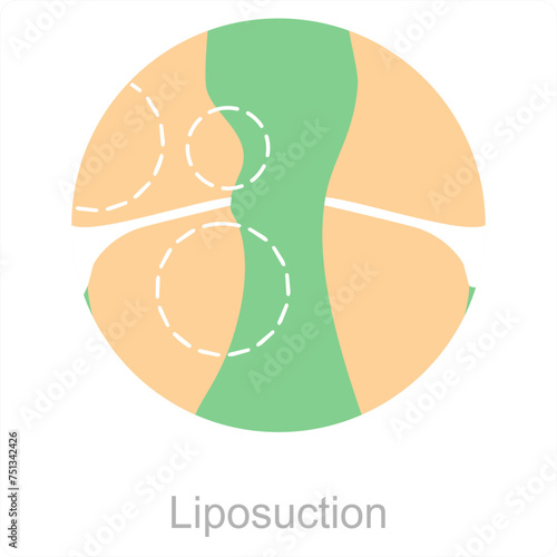 Liposuction