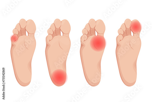 Foot and toes pain vector illustration design