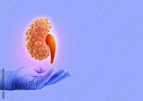 The Nephrologist doctor studies and analyzes kidney cysts, medical care for kidney problems. Organ donor. Isolated scene with light lilac background