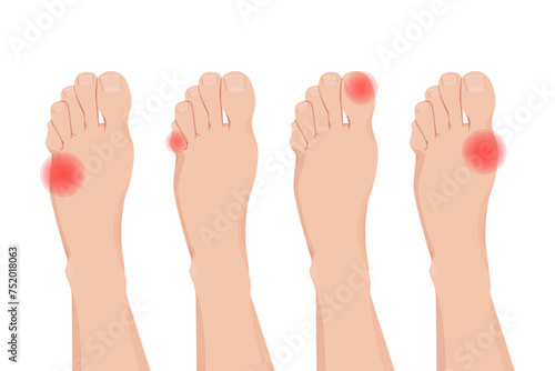 Foot pain and numb vector illustration design.