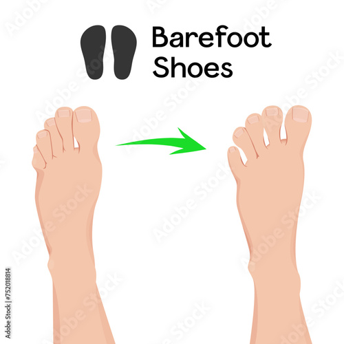 Compare feet before and after barefoot shoes vector illustration.