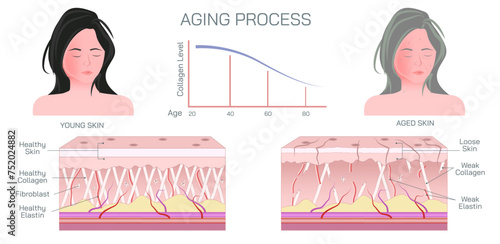 Aging process of skin. Aging skin looks thinner, paler, and clear or translucent. Pigmented spots, including age spots or liver spots may appear in sun exposed areas. Changes in collagen and elastin. photo