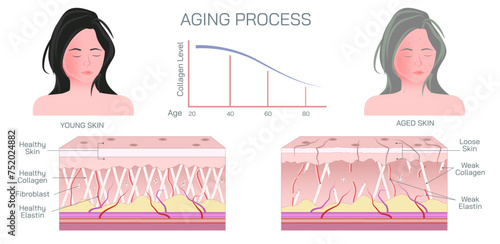 Aging process of skin. Aging skin looks thinner, paler, and clear or translucent. Pigmented spots, including age spots or liver spots may appear in sun exposed areas. Changes in collagen and elastin.