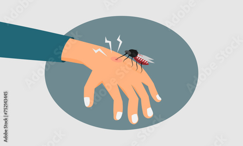 A mosquito bites human hand. Dengue fever or Malaria outbreak concept. Vector illustration. photo