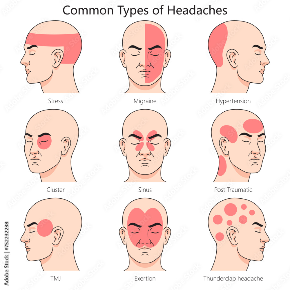 Vetor de Human headache type structure diagram hand drawn schematic ...