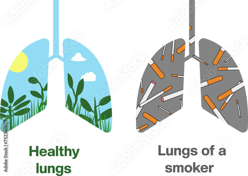 Comparison of two lungs: in healthy - there is a good day, green grass, sun and clouds; in smoker's lungs - just cigarettes... Quit smoking. Vector world no  tobacco day illustration.