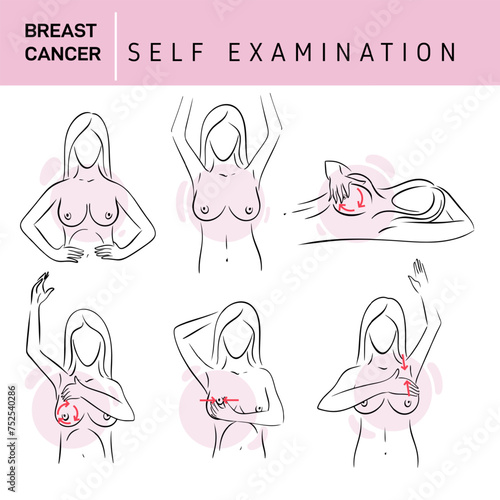 Breast cancer, medical infographic. Women's health set. Woman examining breasts. Prevention of breast cancer. Self-examination. Vector healthcare poster or banner template.