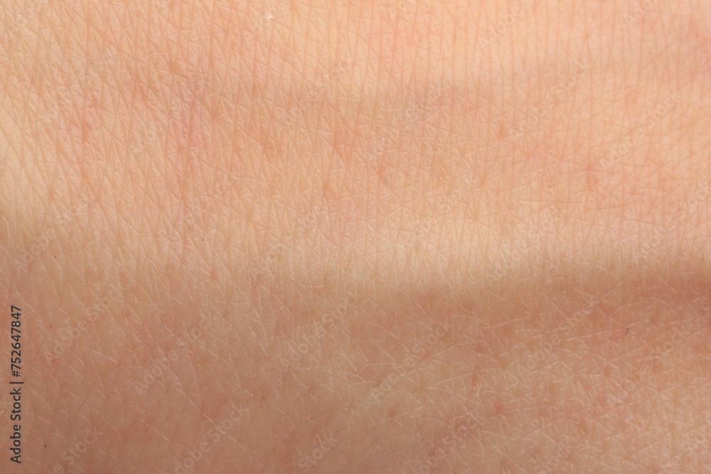 Fototapeta premium Texture of dry skin as background, macro view