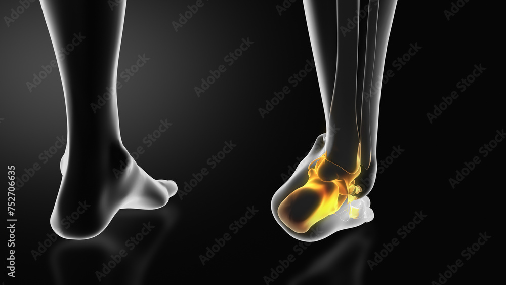 Ankle injury with dislocation and sprains Ankle injury with dislocation and sprains