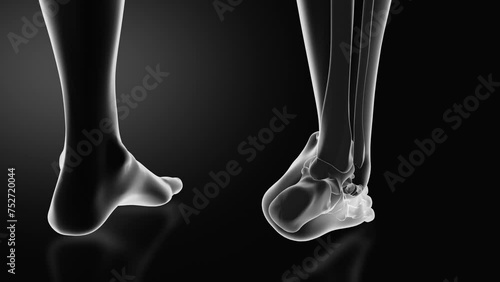 Ankle injury with dislocation and sprains photo