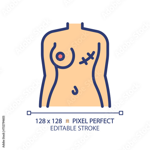 Female breast cancer RGB color icon. Gynecological disease, surgery scar. Woman body trauma. Medical condition. Isolated vector illustration. Simple filled line drawing. Editable stroke