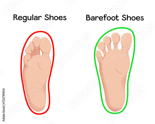 Barefoot shoes impacts on feet vector illustration infographic.