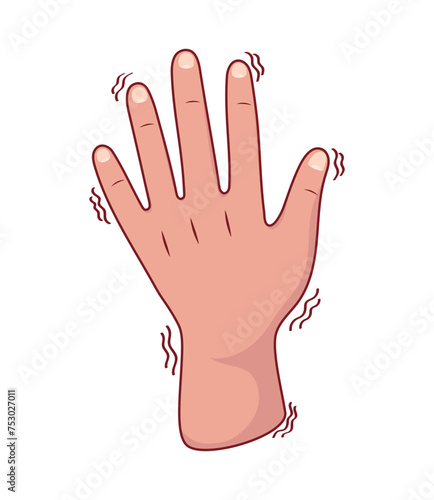 parkinson tremor on the hands