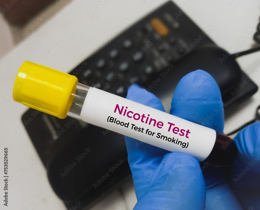 Blood sample for Cotinine or Nicotine test, an alkaloid found in tobacco and also the predominant metabolite of nicotine, it is used as a biomarker for exposure to tobacco smoke.