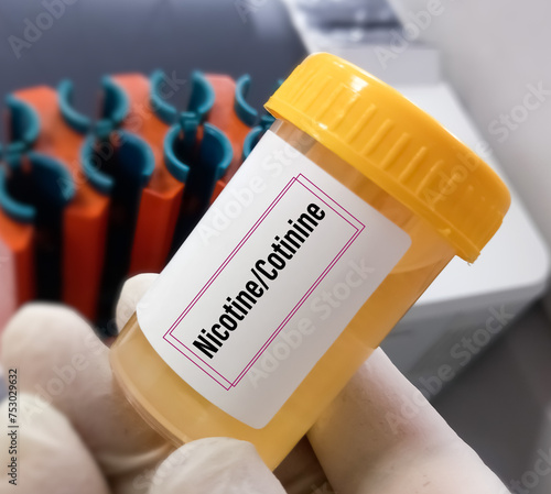 Urine test sample for Cotinine or Nicotine test, an alkaloid found in tobacco and also the predominant metabolite of nicotine, it is used as a biomarker for exposure to tobacco smoke. photo
