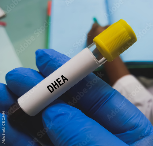 Blood sample for DHEAS (dehydroepiandrosterone sulfate) hormone test. A medical testing concept in the laboratory background. photo