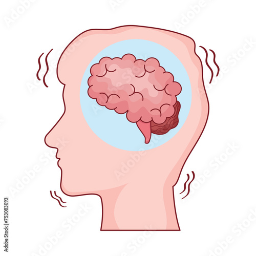 parkinson neuronal system alteration