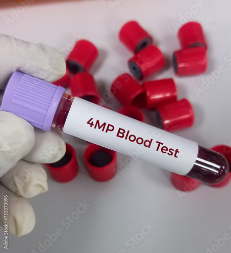Blood sample for blood-based four-marker protein (4MP) panel, can help detect lung cancer earlier. Lung cancer screening blood test.