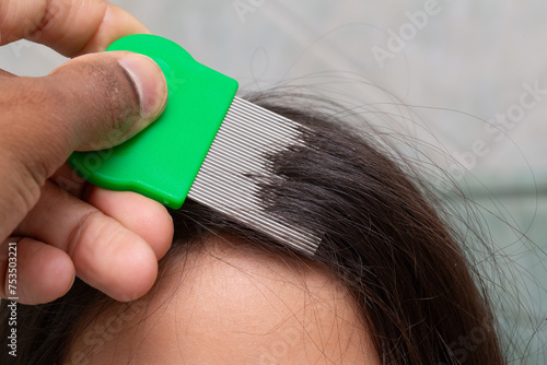 removing lice nits from hair with fine-toothed comb