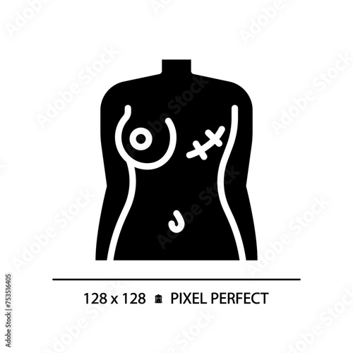 Female breast cancer black glyph icon. Gynecological disease, surgery scar. Woman body trauma. Medical condition. Silhouette symbol on white space. Solid pictogram. Vector isolated illustration