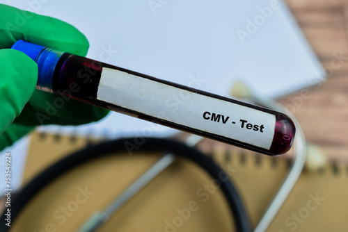 CMV - Test with blood sample on wooden background. Healthcare or medical concept photo