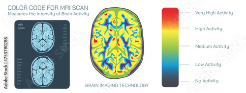 Brain MRI scan vector illustration. Magnetic resonance imaging is a medical imaging technique used in radiology to form pictures of the anatomy and the physiological processes inside the mind.  photo