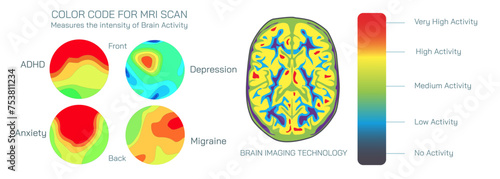 Brain MRI scan vector illustration. Magnetic resonance imaging is a medical imaging technique used in radiology to form pictures of the anatomy and the physiological processes inside the mind. 
