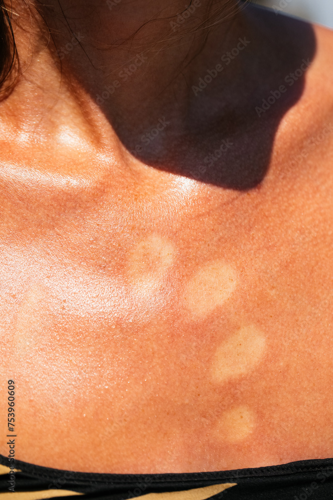 Woman with Fingerprints on Her Chest Woman with Fingerprints on Her Chest