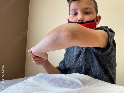 Boy holding up his arm to show his broken elbow. 