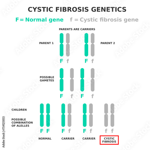 Cystic fibrosis genetics. Cystic fibrosis is an example of a recessive disease. Parents are carriers of affected allele. Children have different possible combination of genes. Vector illustration. 