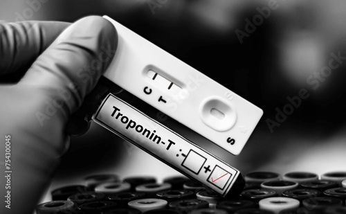 Blood sample of patient positive tested for troponin T by rapid diagnostic test. photo