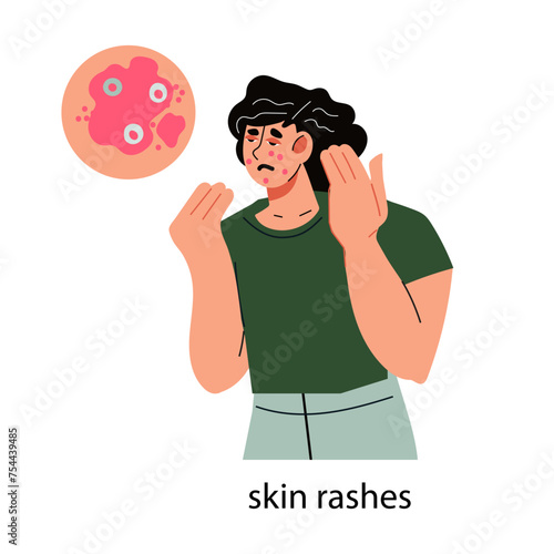 Woman with acne rashes on face skin, flat vector illustration isolated on white. Acne and other dermatological skin problems, inflammation and infections.