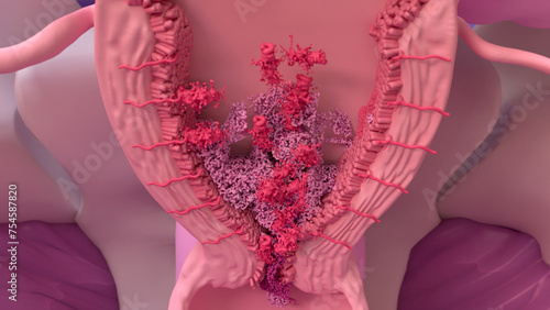 Fotografie Endometriosis, disease of the female reproduction system