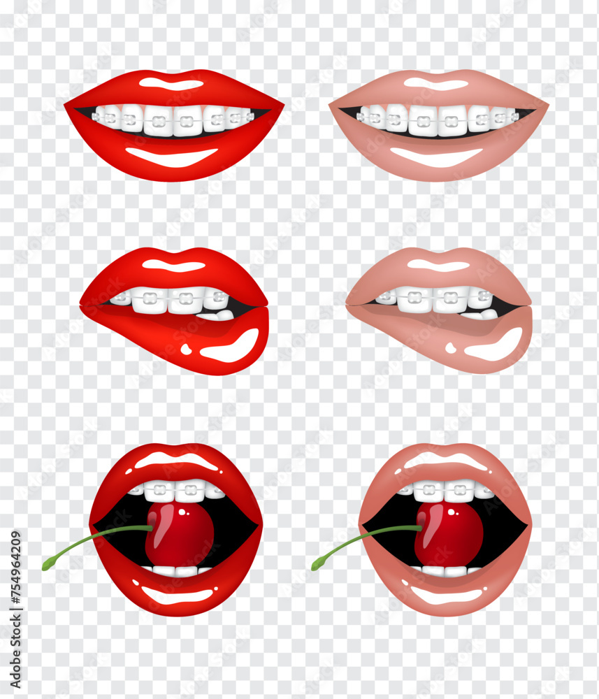 Beautiful sexy female lips in red and beige nude colors and teeth in braces. Set of isolated vector illustrations on transparent background