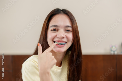 Joyous young female gestures at her braces with a charming smile  comfortable in her home surroundings. Gleeful woman indicates her orthodontic braces with radiant smile  at ease in a domestic setting
