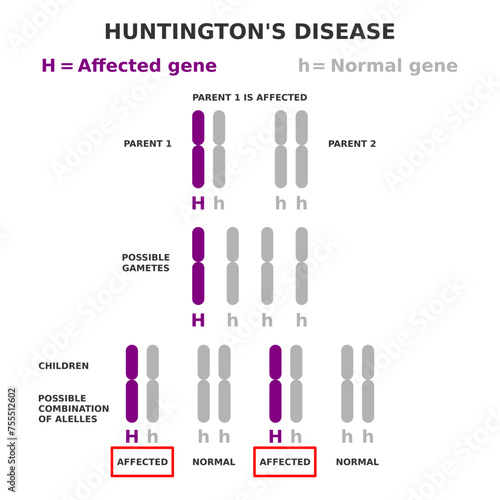 Huntington's disease genetics. Autosomal dominant inheritance. One parent is affected. Children have fifty fifty possibility of inheriting disease. Chromosome 4 HTT is mutated. Vector illustration.  