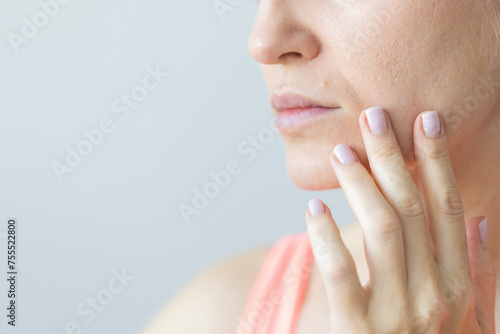 Young woman with nasolabial wrinkles, problem dry skin and with big pores on the face. Woman with the mole above the lip.