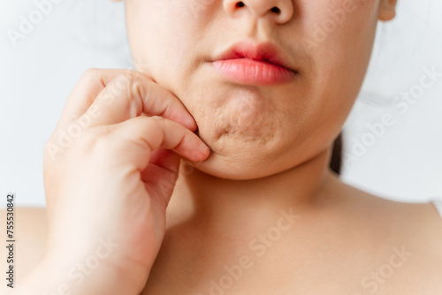 A woman with a puffy face and double chin. photo