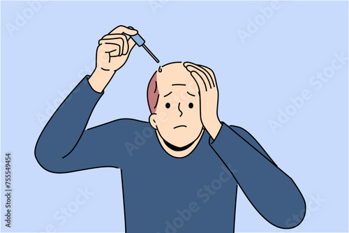 Man treats baldness with dropper of doctor-recommended healing oil that improves hair growth and makes him look attractive. Problem of baldness worries adult guy during midlife crisis