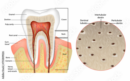 Dentin or dentine Structure. Intertubular dentin, Peritubular dentin, Dentinal tubules. photo