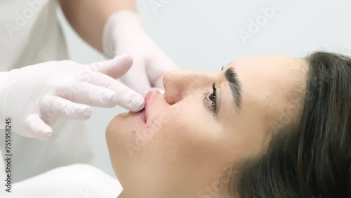 Close-up of a young woman's face undergoing lip augmentation procedure. Cosmetology injections and services. Injection lip correction. photo