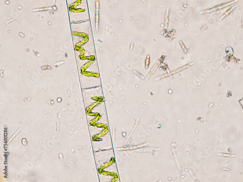 Spirogyra algae (filamentous green algae) under the microscope - optical microscope x400 magnification photo