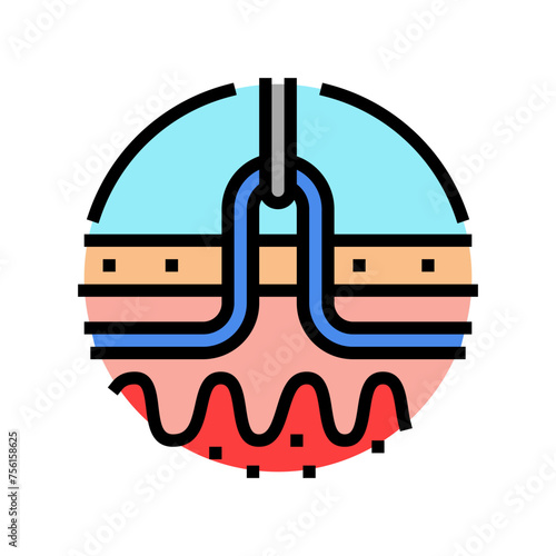 phlebectomy surgery color icon vector. phlebectomy surgery sign. isolated symbol illustration