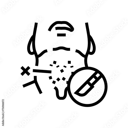 thyroidectomy surgery line icon vector. thyroidectomy surgery sign. isolated contour symbol black illustration