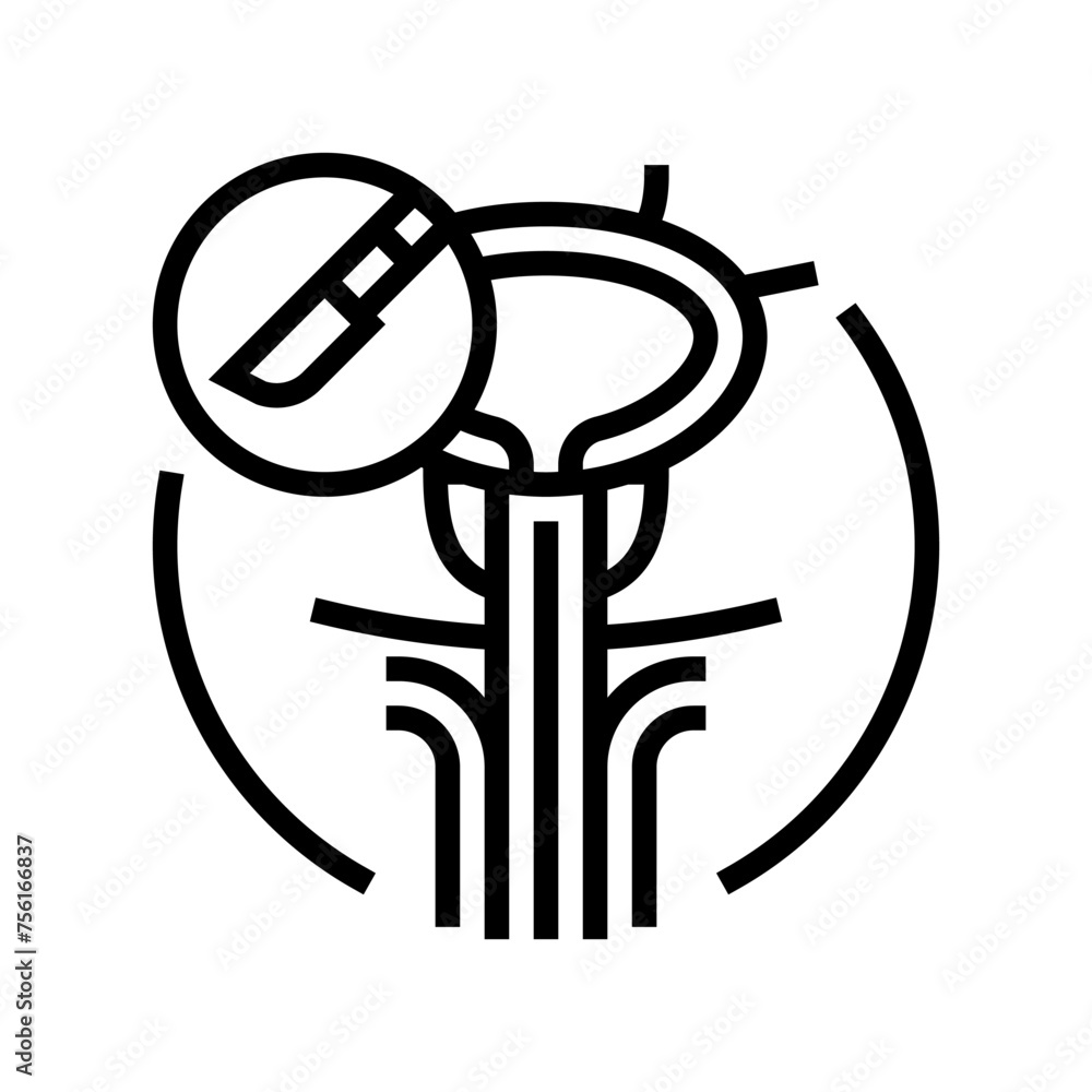 transurethral resection prostate surgery line icon vector. transurethral resection prostate surgery sign. isolated contour symbol black illustration transurethral resection prostate surgery line icon vector. transurethral resection prostate surgery sign. isolated contour symbol black illustration