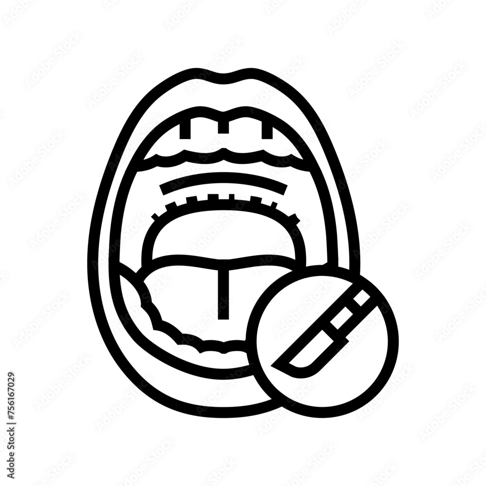uvulopalatopharyngoplasty surgery line icon vector. uvulopalatopharyngoplasty surgery sign. isolated contour symbol black illustration