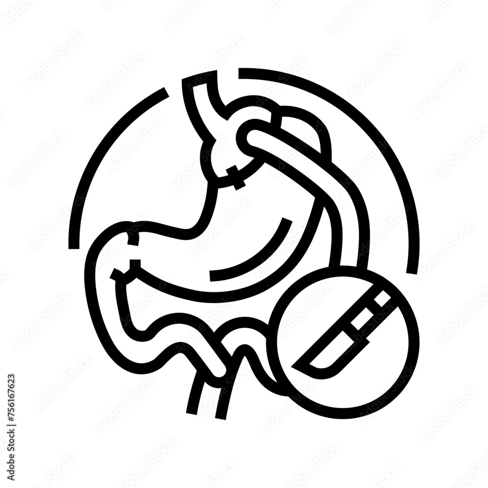 gastric bypass surgery line icon vector. gastric bypass surgery sign. isolated contour symbol black illustration gastric bypass surgery line icon vector. gastric bypass surgery sign. isolated contour symbol black illustration