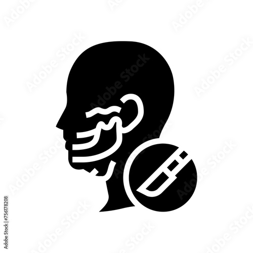 genioplasty surgery glyph icon vector. genioplasty surgery sign. isolated symbol illustration