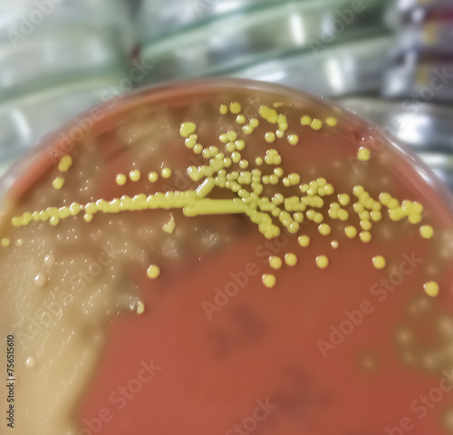 Canvas Print Golden color colonies on chocolate agar medium, growth of staphylococcus aureus, gram positive bacteria at medical microbiology laboratory